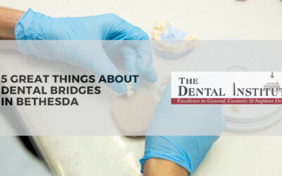 5 Great Things about Dental Bridges in Bethesda