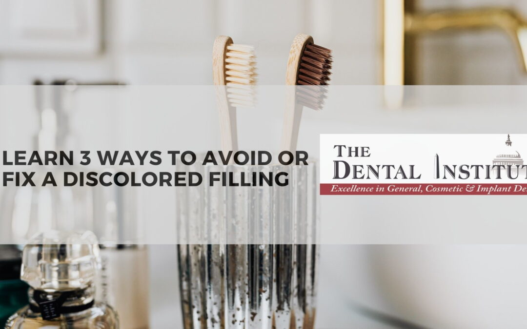 Learn 3 Ways to Avoid or Fix a Discolored Filling